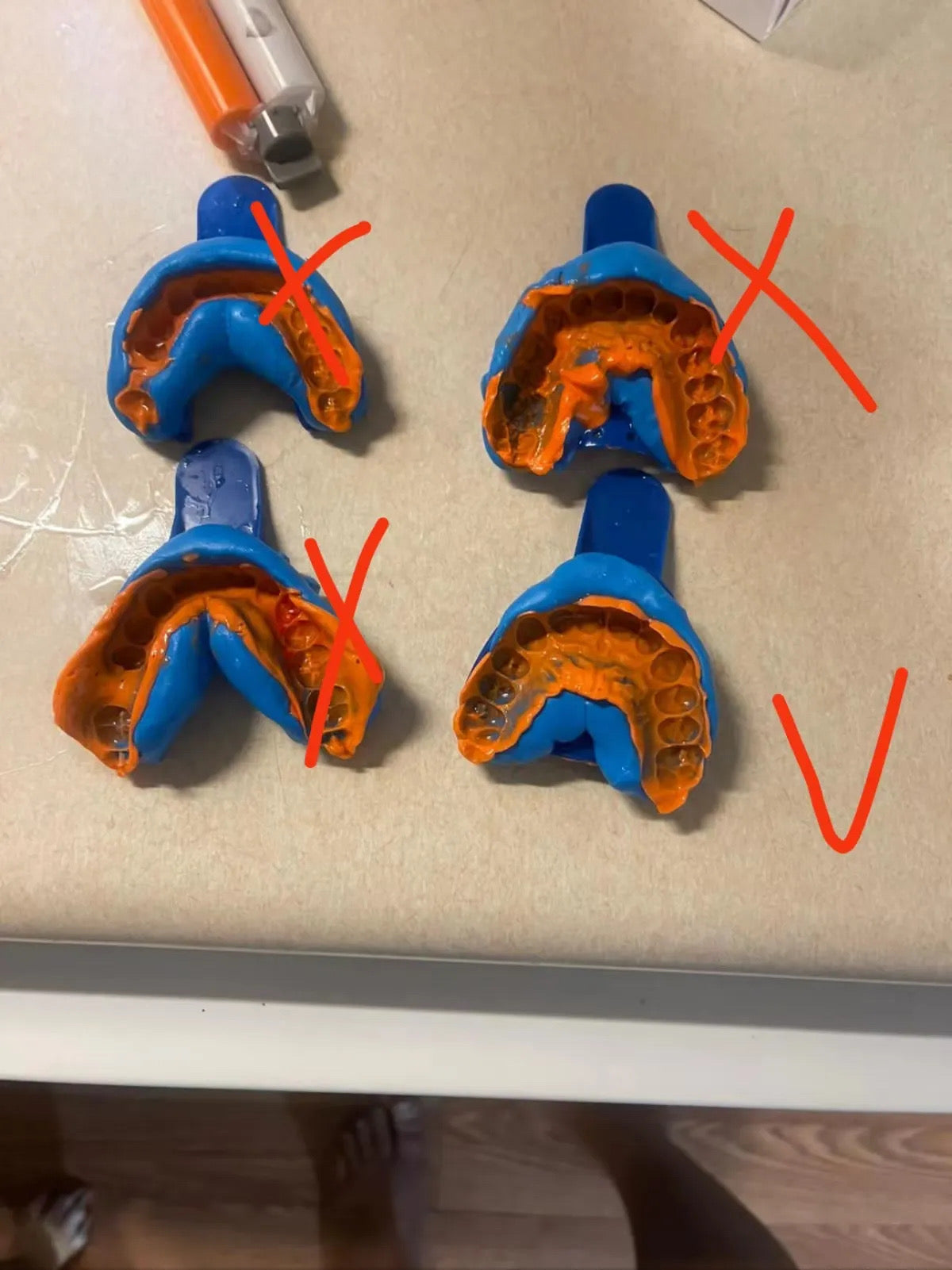 Molding kits